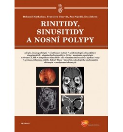 Rinitidy, sinusitidy a nosní polypy