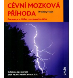 Cévní mozková příhoda