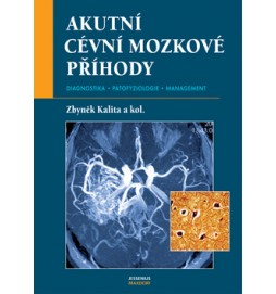 Akutní cévní mozkové příhody