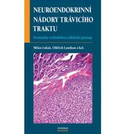 Neuroendokrinní nádory trávicí