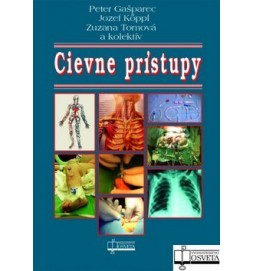 Cievne prístupy
