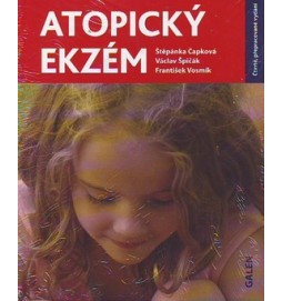 Atopický ekzém