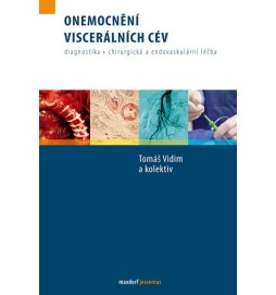 Onemocnění viscerálních cév