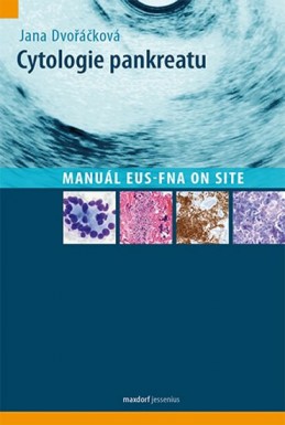 Cytologie pankreatu - Manuál EUS-FNA on site - Dvořáčková Jana
