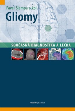 Gliomy - Současná diagnostika a léčba - Šlampa a kolektiv Pavel