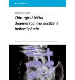Chirurgická léčba degenerativního postižení bederní páteře